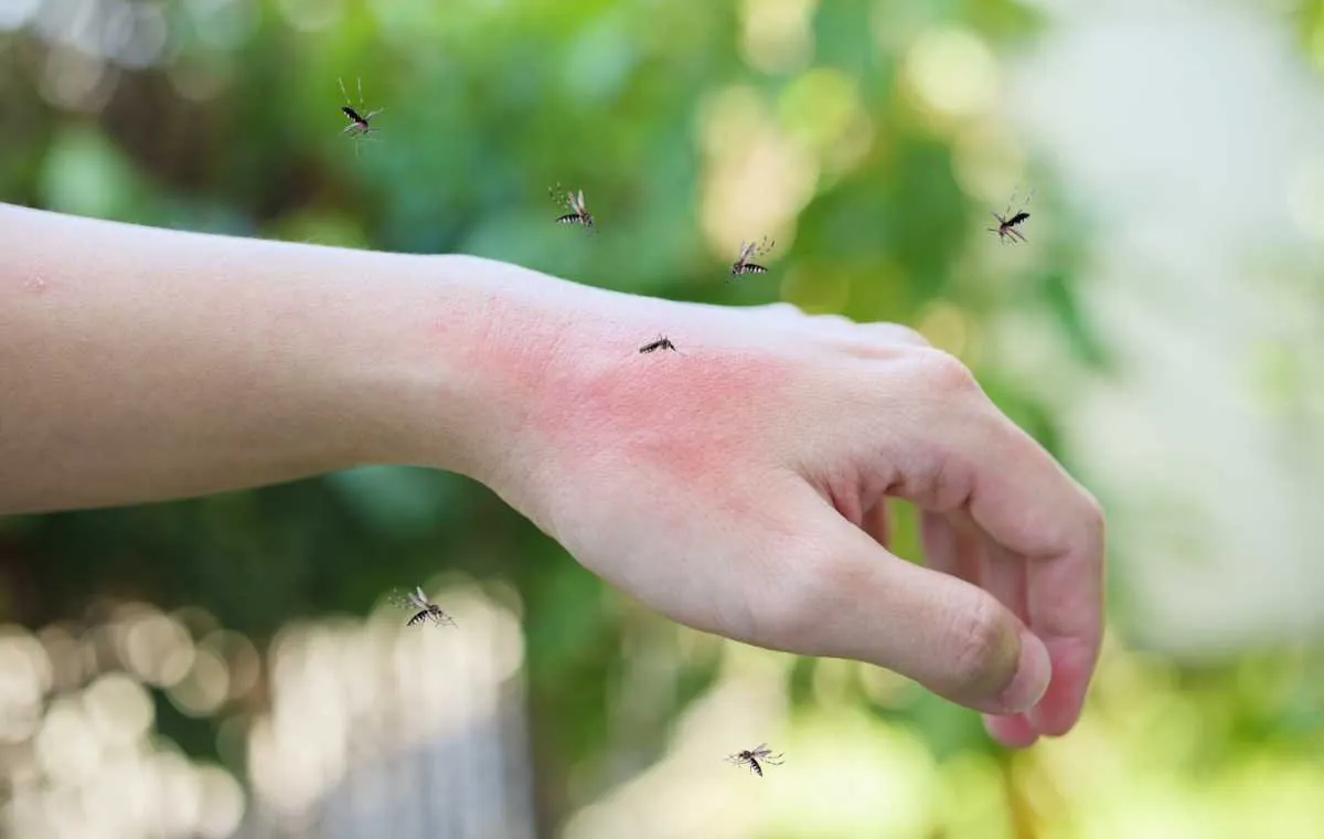 ورم نیش پشنه